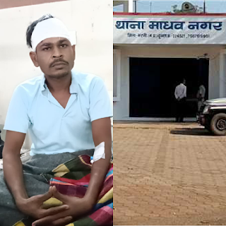 katni news today पत्थर से हमला कर दो युवकों ने युवक को किया लहूलुहान