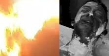 फीस विवाद से नाराज छात्र ने कॉलेज में लगाई खुद को आग